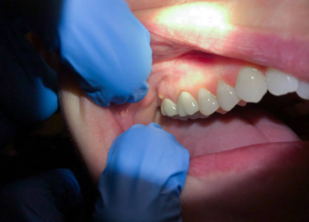 Best Emergency Dentist for Special Needs Patients in Tremonton, UT