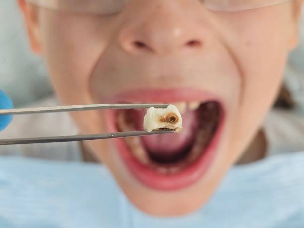 Best Mobile Emergency Dentist in Tremonton, UT